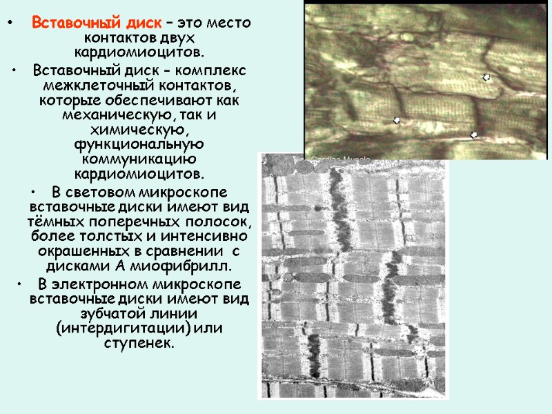 Вставочный диск – это место контактов двух кардиомиоцитов.  Вставочный диск - комплекс межклеточный